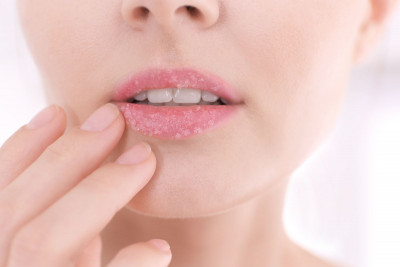 Dapatkan Bibir yang Lebih Cantik dengan Scrub Madu